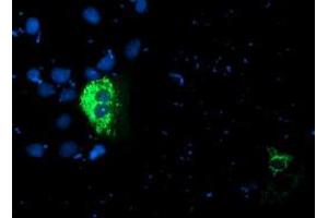 Anti-PDSS2 mouse monoclonal antibody (ABIN2455335) immunofluorescent staining of COS7 cells transiently transfected by pCMV6-ENTRY PDSS2 (RC207892). (PDSS2 anticorps)