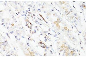 Immunohistochemistry of paraffin-embedded Human stomach using Vimentin Polyclonal Antibody at dilution of 1:150 (40x lens). (Vimentin anticorps)