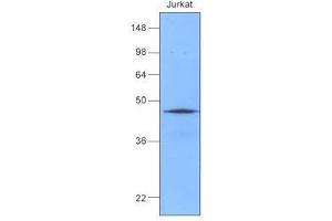 Cell lysates of Jurkat (50 ug) were resolved by SDS-PAGE, transferred to nitrocellulose membrane and probed with anti-human Hsp40 (1:1,000).