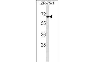 Western blot analysis in ZR-75-1 cell line lysates (35ug/lane). (GTF3C5 anticorps  (AA 287-316))