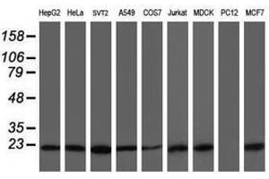 Image no. 3 for anti-Prefoldin Subunit 3 (PFDN3) antibody (ABIN1501700)