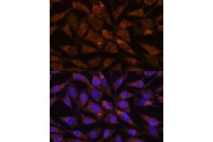 Immunofluorescence analysis of L929 cells using LM antibody (ABIN7268203) at dilution of 1:100.