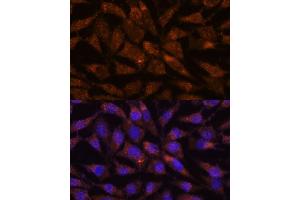 Immunofluorescence analysis of L929 cells using LM antibody (ABIN7268203) at dilution of 1:100. (LMAN2 anticorps  (AA 190-320))