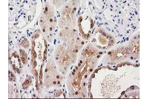 Immunohistochemical staining of paraffin-embedded Human Kidney tissue using anti-SULT1C2 mouse monoclonal antibody. (SULT1C2 anticorps)