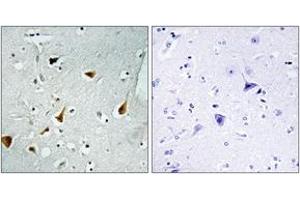 Immunohistochemistry analysis of paraffin-embedded human brain tissue, using STAT6 (Ab-641) Antibody. (STAT6 anticorps  (AA 608-657))