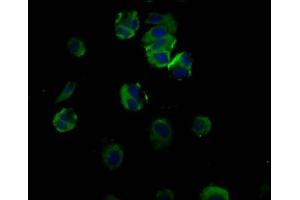 Immunofluorescence staining of MCF-7 cells with ABIN7172799 at 1:66, counter-stained with DAPI.