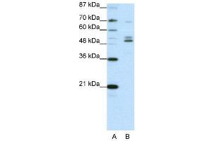 WB Suggested Anti-FOXA2  Antibody Titration: 0. (FOXA2 anticorps  (C-Term))
