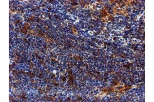 Image no. 9 for anti-Sepiapterin Reductase (SPR) antibody (ABIN1501115)