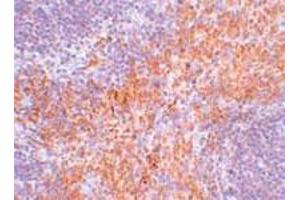Immunohistochemical staining of mouse kidney tissue with 2.