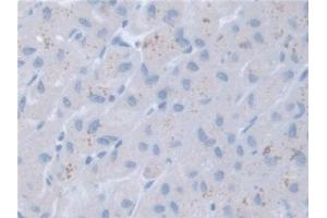 Detection of RARa in Human Liver Tissue using Polyclonal Antibody to Retinoic Acid Receptor Alpha (RARa)