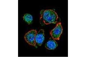 Confocal immunofluorescent analysis of  MITF Antibody (N-term) Cat.