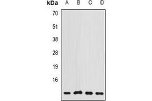 Western blot analysis of COX7A2L expression in MCF7 (A), A549 (B), Hela (C), mouse brain (D) whole cell lysates. (COX7A2L anticorps)