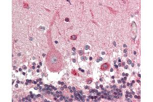 Anti-KCNN1 antibody IHC staining of human brain, cerebellum. (KCNN1 anticorps  (AA 441-490))