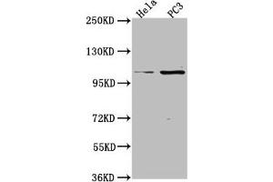 Western Blot Positive WB detected in: Hela whole cell lysate, PC3 whole cell lysate All lanes: PKN3 antibody at 1:2000 Secondary Goat polyclonal to rabbit IgG at 1/50000 dilution Predicted band size: 100 kDa Observed band size: 100 kDa (PKN3 anticorps  (AA 1-252))