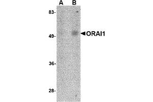 Western Blotting (WB) image for anti-ORAI Calcium Release-Activated Calcium Modulator 1 (ORAI1) antibody (ABIN1031712)
