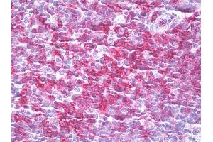 Anti-CD27 antibody IHC of human tonsil. (CD27 anticorps)