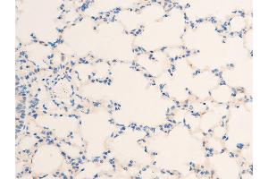 ABIN6267220 at 1/100 staining mouse lung tissue sections by IHC-P.