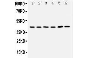 Anti-TRAM1 antibody, Western blotting Lane 1: Rat Brain Tissue Lysate Lane 2: Rat Kidney Tissue Lysate Lane 3: 293T Cell Lysate Lane 4: RAJI Cell Lysate Lane 5: JURKAT Cell Lysate (TRAM1 anticorps  (C-Term))