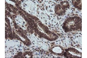 Image no. 9 for anti-Carboxypeptidase A2 (Pancreatic) (CPA2) antibody (ABIN1497598)