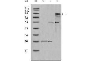 Western Blot showing MPO antibody used against truncated Trx-MPO recombinant protein (1),truncated MBP-MPO (aa1-193) recombinant protein (2) and truncated MPO (aa165-745)-hIgGFc transfected CHO-K1 cell lysate (3). (Myeloperoxidase anticorps  (AA 1-193))