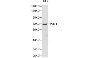 Western Blotting (WB) image for anti-Protection of Telomeres 1 (POT1) antibody (ABIN2650945) (POT1 anticorps)