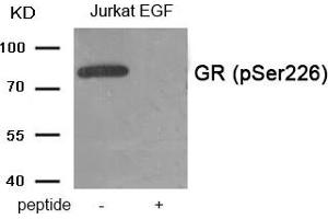 Western blot analysis of extracts from Jurkat cells treated with EGF using Phospho-GR (Ser226) antibody. (Glucocorticoid Receptor anticorps  (pSer226))