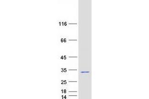 Validation with Western Blot