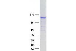 Validation with Western Blot