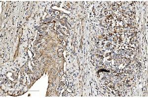 IHC analysis of COL4A3 using anti-COL4A3 antibody (ABIN7600055).