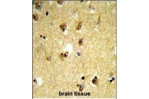 Formalin-fixed and paraffin-embedded human brain tissue reacted with KCTD12 Antibody (Center), which was peroxidase-conjugated to the secondary antibody, followed by DAB staining.