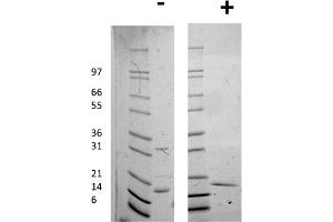SDS-PAGE of Human Interleukin-16 Recombinant Protein SDS-PAGE of Human Interleukin-16 Recombinant Protein. (IL16 Protéine)