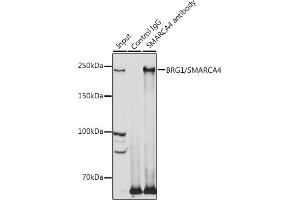 Immunoprecipitation analysis of 300 μg extracts of 293T cells using 3 μg BRG1/BRG1/SM antibody (ABIN3022958, ABIN3022959, ABIN3022960 and ABIN6219317).