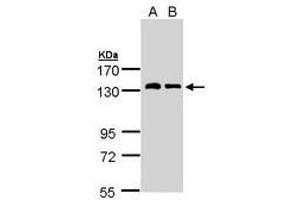 Image no. 1 for anti-Natriuretic Peptide Receptor A/guanylate Cyclase A (Atrionatriuretic Peptide Receptor A) (NPR1) (AA 640-886) antibody (ABIN467522) (NPR1 anticorps  (AA 640-886))