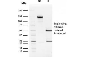 SDS-PAGE Analysis Purified TIM3 Mouse Monoclonal Antibody (TIM3/2399). (TIM3 anticorps  (AA 22-202))