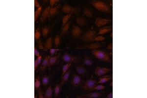 Immunofluorescence analysis of C6 cells using GCAT antibody (ABIN7267461) at dilution of 1:100.
