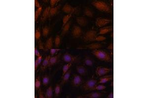 Immunofluorescence analysis of C6 cells using GCAT antibody (ABIN7267461) at dilution of 1:100. (GCAT anticorps  (AA 170-419))