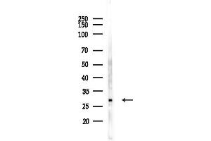 anti-Charged Multivesicular Body Protein 4B (CHMP4B) (N-Term) antibody