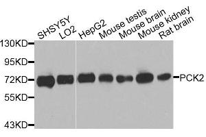 Western blot analysis of extracts of various cell lines, using PCK2 antibody. (PEPCK anticorps  (AA 1-280))