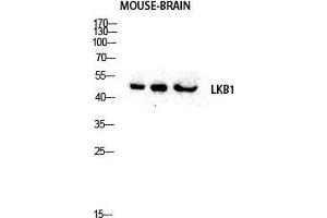 Western Blot (WB) analysis of Mouse Brain lysis using LKB1 antibody.