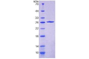 SDS-PAGE analysis of Mouse VAV1 Protein. (VAV1 Protéine)