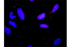Proximity Ligation Analysis of protein-protein interactions between MAPK8 and FASLG.