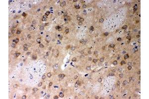 IHC-P: PP2A antibody testing of rat brain tissue