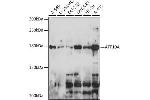 Western blot analysis of extracts of various cell lines, using A antibody (ABIN7265756) at 1:1000 dilution. (ATP10A anticorps  (AA 440-690))