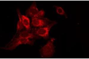 ABIN6278417 staining NIH-3T3 by IF/ICC. (TACR2 anticorps  (C-Term))