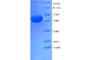 SDS-PAGE (SDS) image for Prefoldin Subunit 1 (PFDN1) (AA 2-122) protein (GST tag) (ABIN5712155)