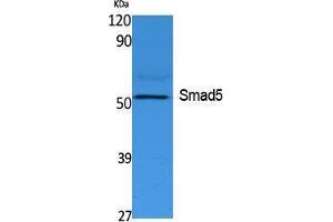 Western Blotting (WB) image for anti-SMAD, Mothers Against DPP Homolog 5 (SMAD5) (Internal Region) antibody (ABIN3187646) (SMAD5 anticorps  (Internal Region))
