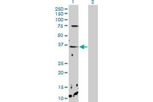 Western Blot analysis of CHP expression in transfected 293T cell line by CHP MaxPab polyclonal antibody. (CHP anticorps  (AA 1-195))