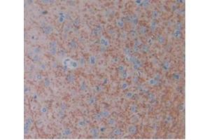 Detection of FGF1 in Rat Brain Tissue using Monoclonal Antibody to Fibroblast Growth Factor 1, Acidic (FGF1) (FGF1 anticorps  (AA 16-155))