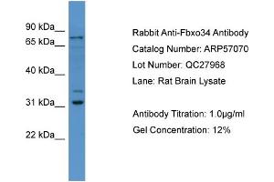 WB Suggested Anti-Fbxo34  Antibody Titration: 0. (FBXO34 anticorps  (N-Term))