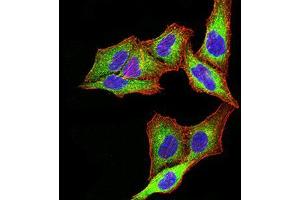 Immunofluorescence analysis of SK-OV-3 cells using PSMC3 mouse mAb (green).